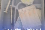 تزریق غیرقانونی ژل و بوتاکس در منزل؛ متخلف به مراجع قضایی معرفی شد